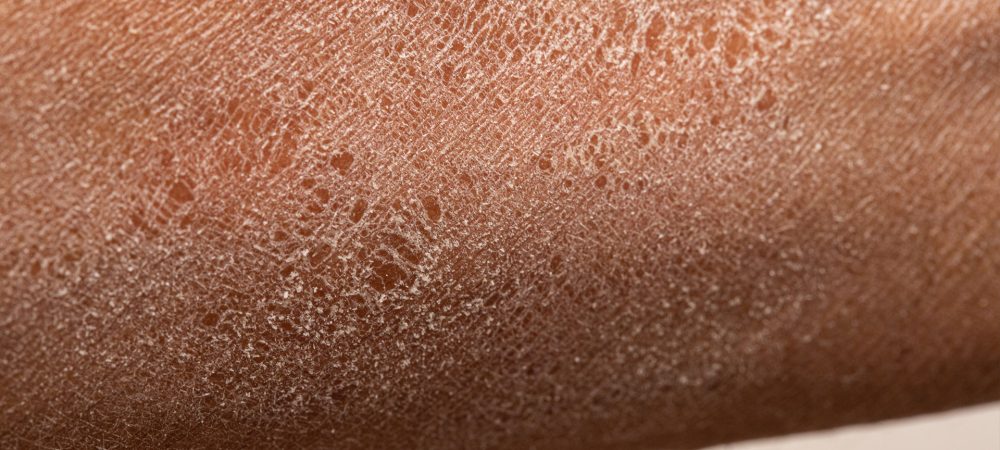 Cuidado de la epidermis